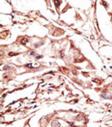 AP11556PU-N - Dickkopf-4 (DKK4)