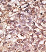 AP11557PU-N - Dickkopf-4 (DKK4)