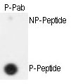 AP12707PU-N - Separin / ESPL1