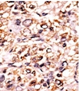 AP12707PU-N - Separin / ESPL1