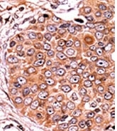 AP12709PU-N - SMAD3