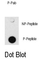 AP12711PU-N - SMAD4