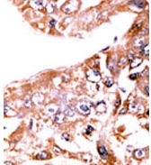 AP12715PU-N - STAT1
