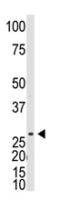 AP11559PU-N - Dickkopf-like protein 1