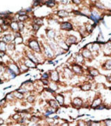 AP11559PU-N - Dickkopf-like protein 1