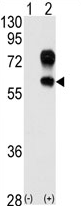 AP11560PU-N - Kremen protein 1