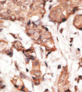 AP11564PU-N - STAT2
