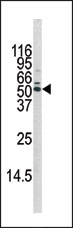 AP12558PU-N - AKT1 / PKB