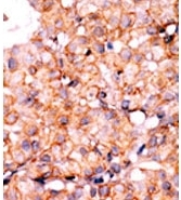 AP12558PU-N - AKT1 / PKB