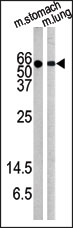 AP12559PU-N - AKT1 / PKB