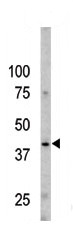 AP12575PU-N - Caspase-9