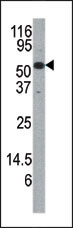 AP12576PU-N - CDC25A