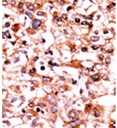 AP12587PU-N - CDK1