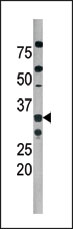 AP12589PU-N - CDK2