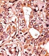AP12590PU-N - CDK7
