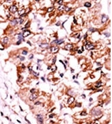 AP12592PU-N - CHK1