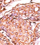 AP12593PU-N - AP-1 / c-Jun