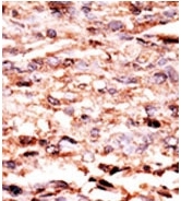 AP12594PU-N - AP-1 / c-Jun