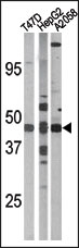 AP12602PU-N - E2F1
