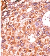 AP12602PU-N - E2F1