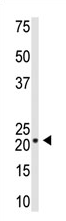 AP11591PU-N - Visinin-like protein 1 / HLP3