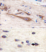 AP11591PU-N - Visinin-like protein 1 / HLP3