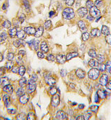 AP11591PU-N - Visinin-like protein 1 / HLP3
