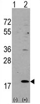 AP11593PU-N - Hippocalcin-like protein 1 (HPCAL1)