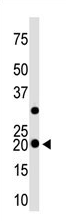 AP11593PU-N - Hippocalcin-like protein 1 (HPCAL1)
