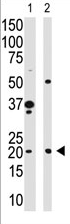 AP11595PU-N - HPCA / Hippocalcin