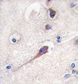 AP11595PU-N - HPCA / Hippocalcin