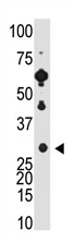 AP11597PU-N - Recoverin