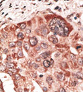 AP11597PU-N - Recoverin