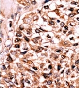 AP12609PU-N - FADD