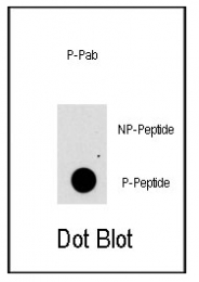AP12611PU-N - FGFR1