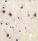 AP11605PU-N - Calmodulin