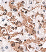 AP11608PU-N - Calsenilin