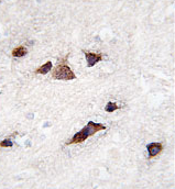 AP11608PU-N - Calsenilin
