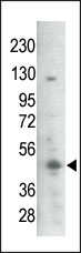 AP12618PU-N - GSK3 beta