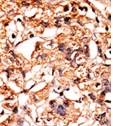 AP12618PU-N - GSK3 beta