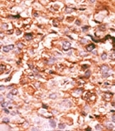 AP12620PU-N - Histone H3.1
