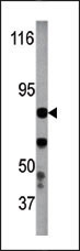 AP12624PU-N - IKBKB / IKKB