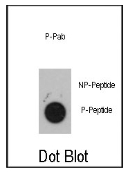 AP12635PU-N - MAPKAP Kinase-2