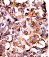 AP12635PU-N - MAPKAP Kinase-2