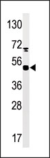 AP12637PU-N - MAPKAP Kinase-5