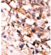AP12637PU-N - MAPKAP Kinase-5
