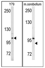 AP12517PU-N - Autotaxin / ENPP2