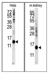 AP12535PU-N - Cytidine deaminase