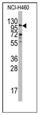 AP12539PU-N - Exonuclease 1 (EXO1)