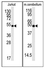 AP12427PU-N - Neuron specific enolase
